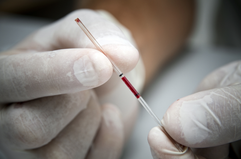 PAHO: Latin America has come to a halt in the response to HIV